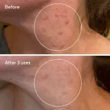 Murad Rapid Relief Sulfur Mask очищающая маска для лица с серой и глиной 74 мл — фото 4