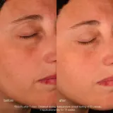 Dermalogica Pro-Collagen Banking Serum укрепляющая сыворотка для лица с коллагеном 30 мл — фото 4