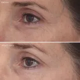 Murad Retinal ReSculpt Eye Treatment крем для кожи вокруг глаз с ретиналем 15 мл — фото 4