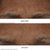 Clinique Smart Clinical Repair AM/PM Retinoid Balm бальзам-стик для лица с ретиноидом 4 г — фото 2