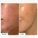 Paula's Choice The Protect and Glow Kit набор для лица эксфолиант и дневной крем 30 мл + 15 мл — фото 1